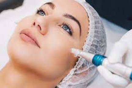 میکرونیدلینگ چیست؟